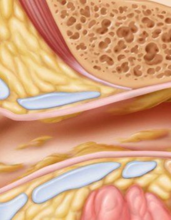 Jak naturalnie złagodzić ból ucha? Mój sprawdzony sposób