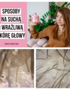 Padłaś? Poleż! Nie poprawiaj korony i nie zasuwaj dalej.